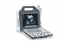 Portable ultrasound scanner N5